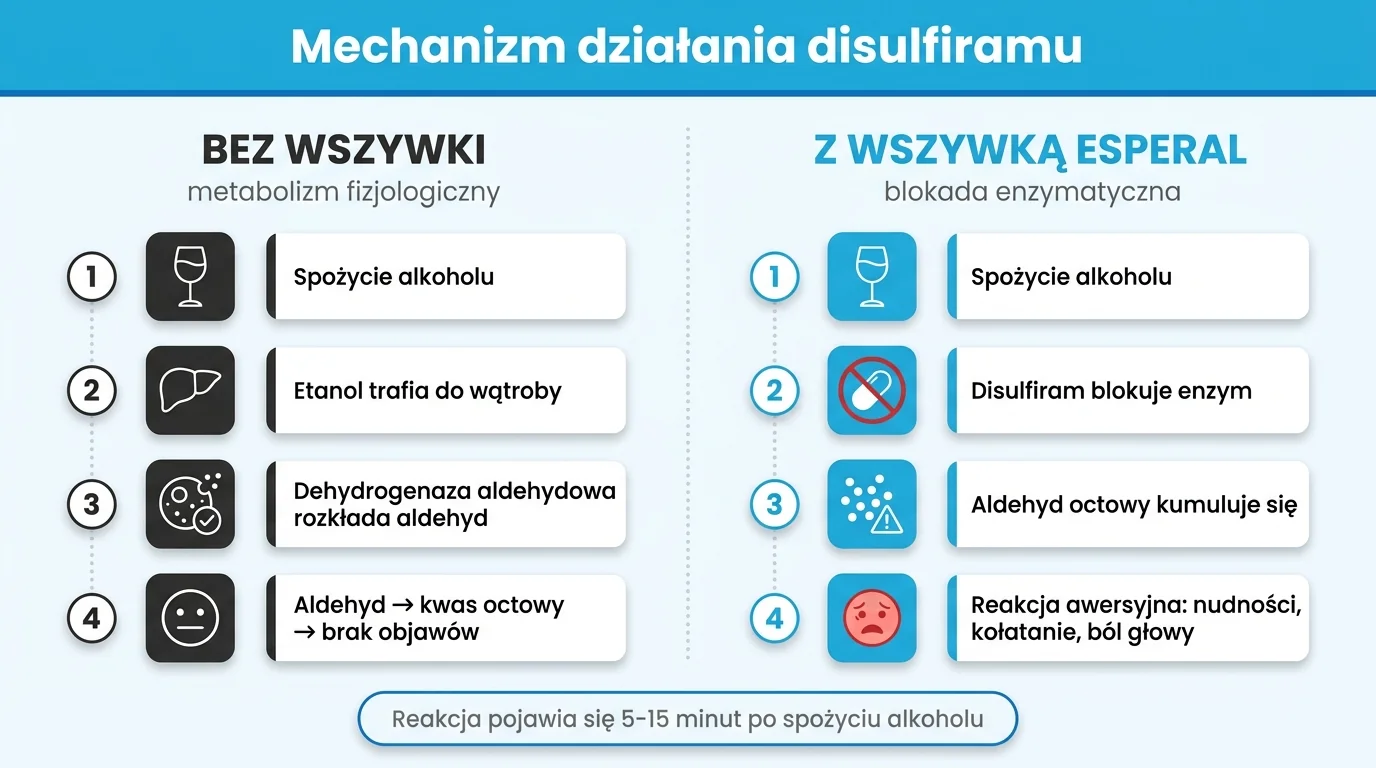 Mechanizm działania Disulfiramu w wszywce alkoholowej Esperal - porównanie metabolizmu alkoholu bez wszywki (etanol, dehydrogenaza aldehydowa, kwas octowy, brak objawów) z metabolizmem przy aktywnym implancie, gdzie Disulfiram blokuje enzym ALDH, aldehyd octowy kumuluje się we krwi i wywołuje reakcję awersyjną (nudności, kołatanie serca, ból głowy) w 5-15 minut od spożycia alkoholu - infografika dla pacjentów Nasz Gabinet Łódź
