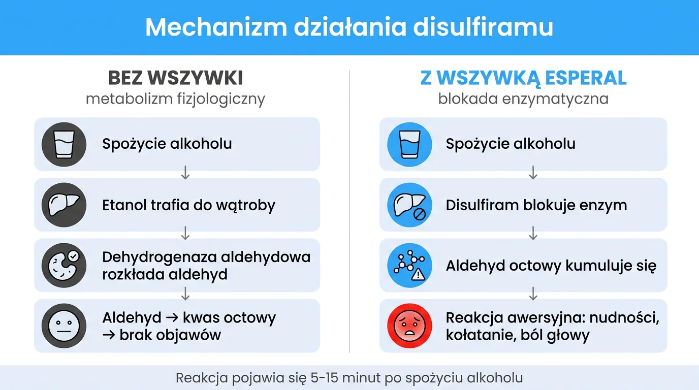 Mechanizm działania Disulfiramu - porównanie metabolizmu alkoholu bez wszywki (etanol, dehydrogenaza aldehydowa, kwas octowy, brak objawów) z metabolizmem przy aktywnej wszywce Esperal, gdzie Disulfiram blokuje enzym, aldehyd octowy kumuluje się i wywołuje reakcję awersyjną w ciągu 5-15 minut od spożycia alkoholu
